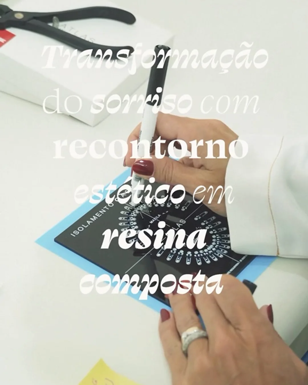 Arte sobre transformação do sorriso com recontorno estético em resina composta
